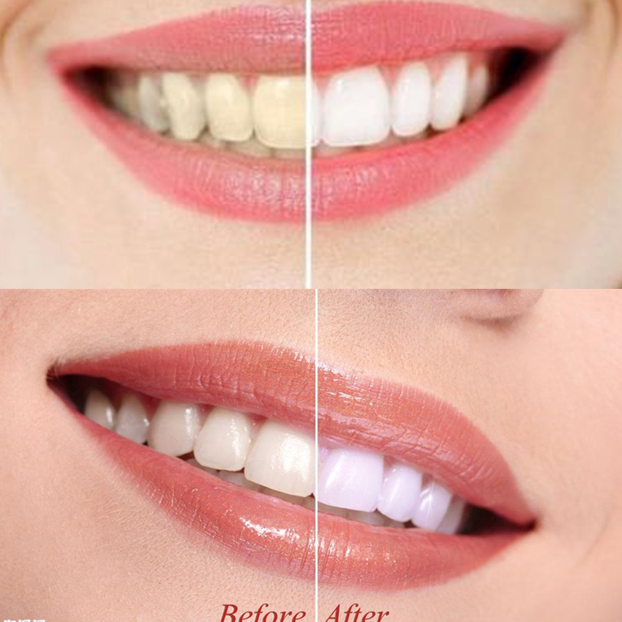 Бамбуковый уголь для зубов, ст – обзор и цена Teeth Whitening Quotes