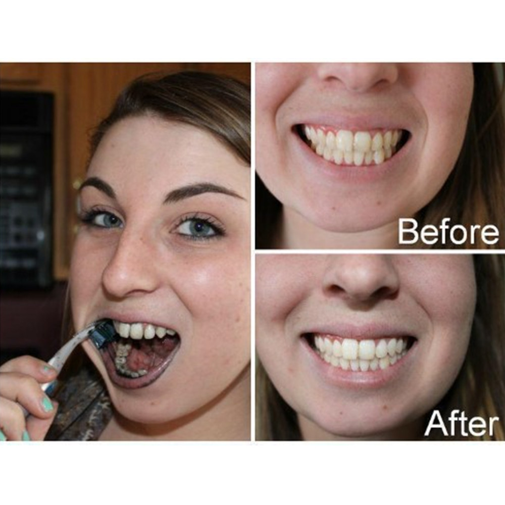 Бамбуковый уголь для зубов, ст – обзор и цена Teeth Whitening Quotes