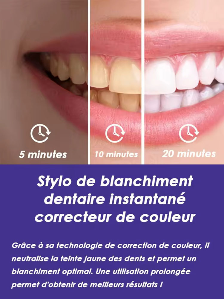 Набор из 2-х гелевых ручек для – обзор и цена Teeth Whitening Gel Pen