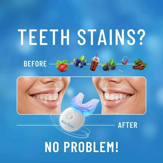 Высококачественный набор для о – обзор и цена Teeth Whitening At Home Kit