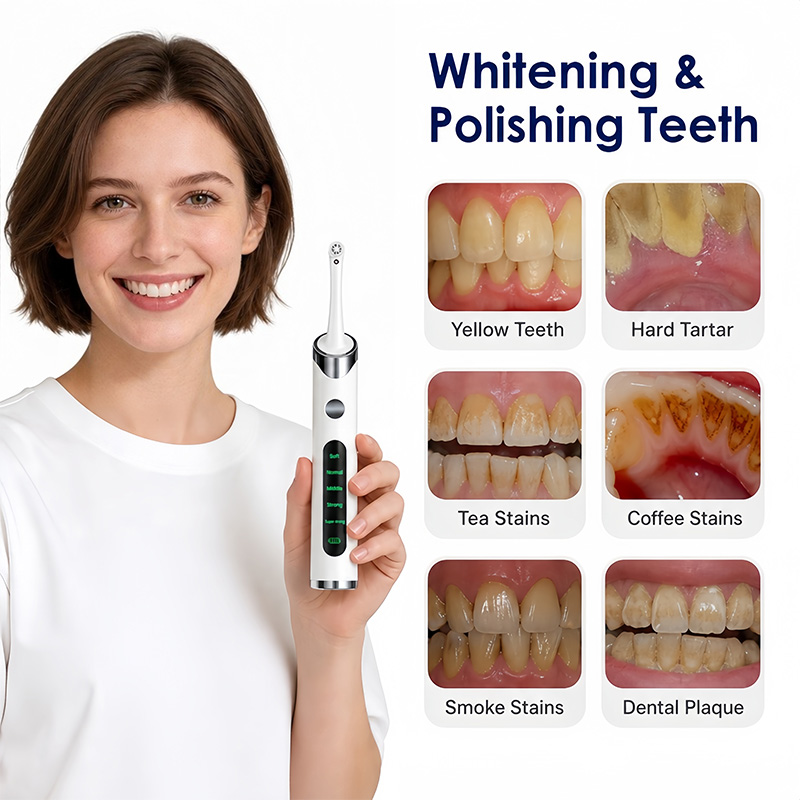 Набор для полировки и отбелива – обзор и цена Teeth Whitening Kit With Light