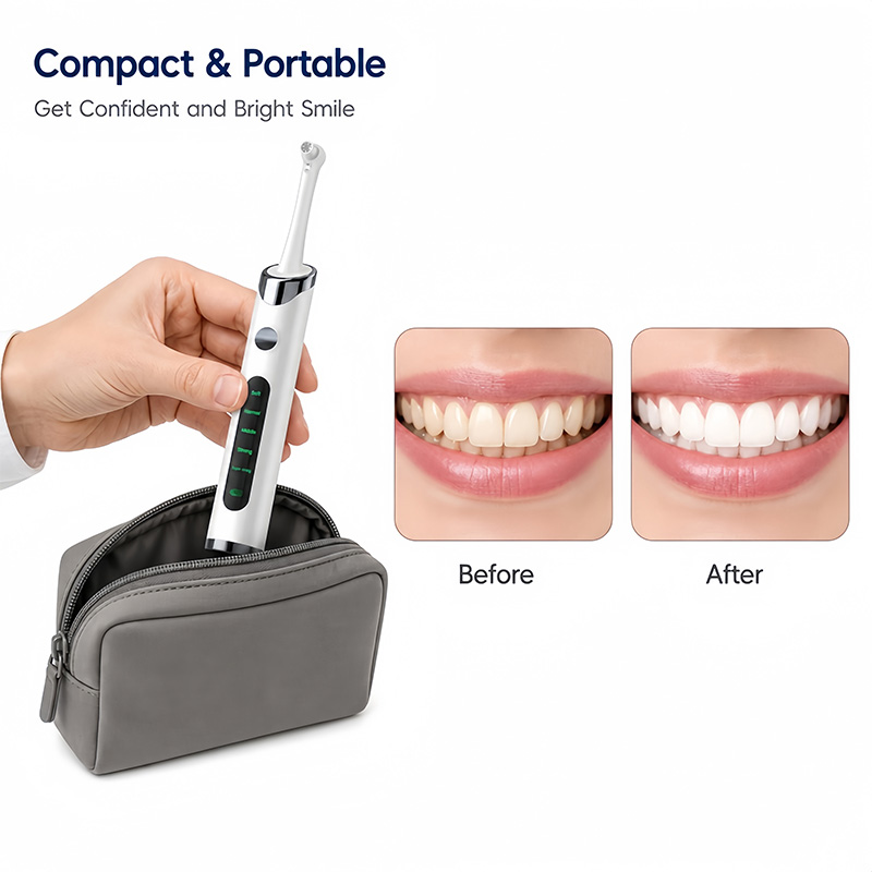 Набор для полировки и отбелива – обзор и цена Teeth Whitening Kit With Light
