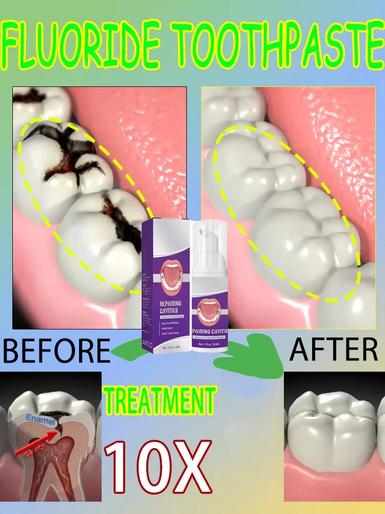 Горячие продажи. Самые продава – обзор и цена Teeth Whitening That Works