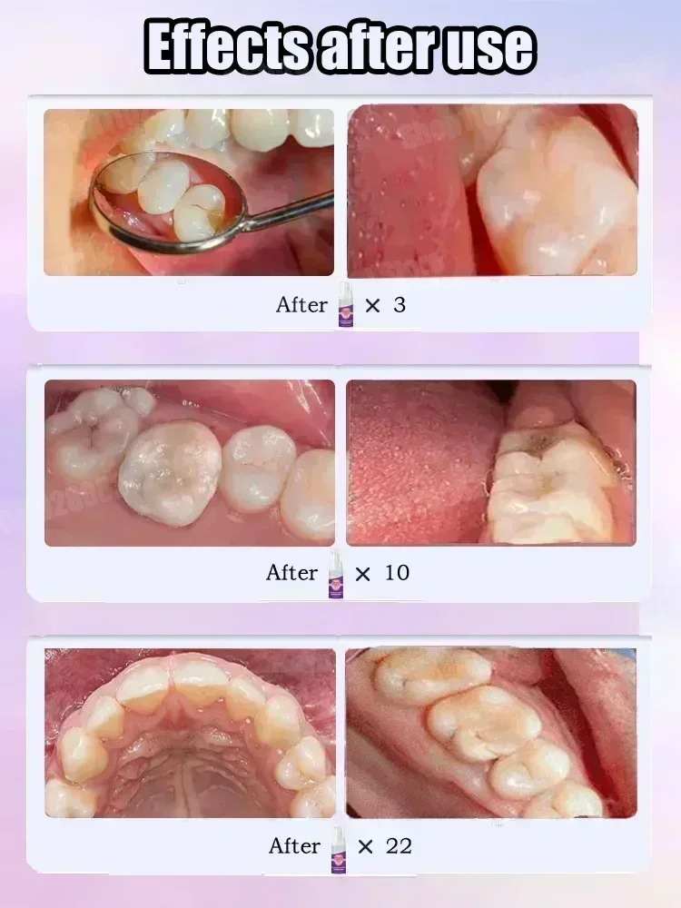Горячие продажи. Самые продава – обзор и цена Teeth Whitening That Works