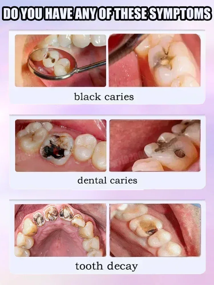Горячие продажи. Самые продава – обзор и цена Teeth Whitening That Works