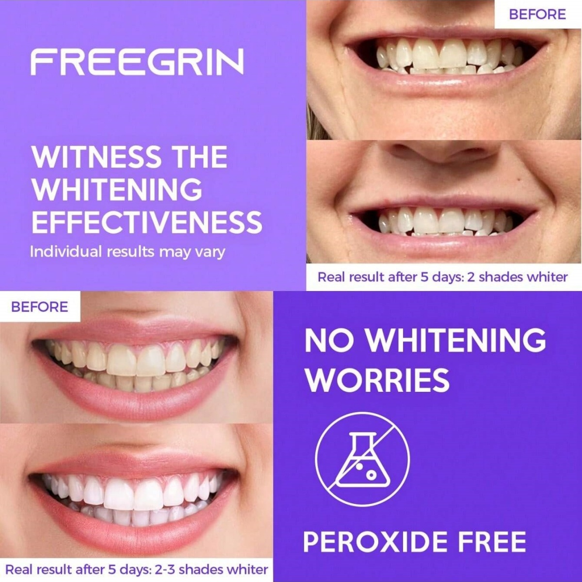 Роскошные отбеливающие наклейк – обзор и цена Teeth Whitening Quotes