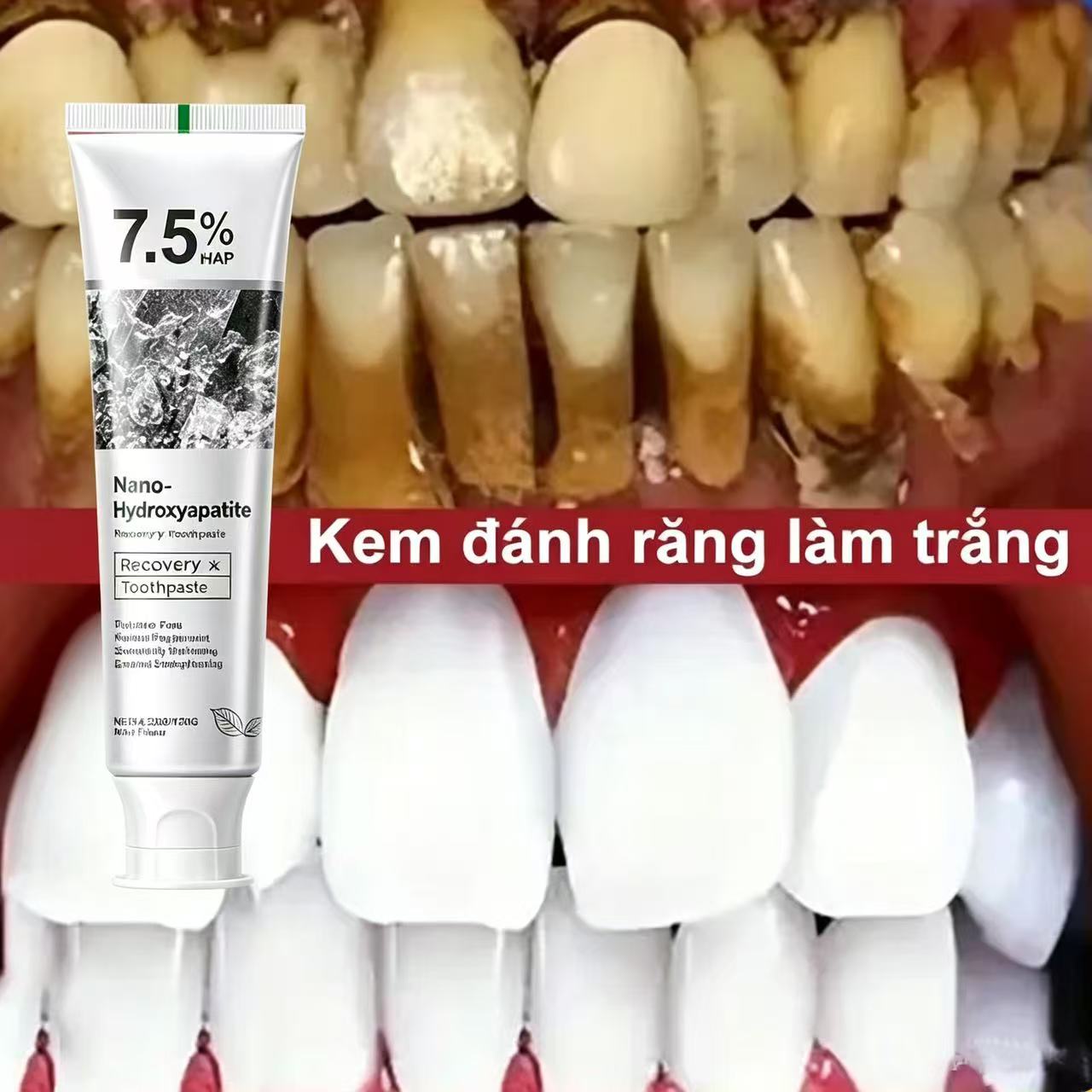 Зубная паста с 7,5% гидроксиап – обзор и цена Teeth Whitening That Works